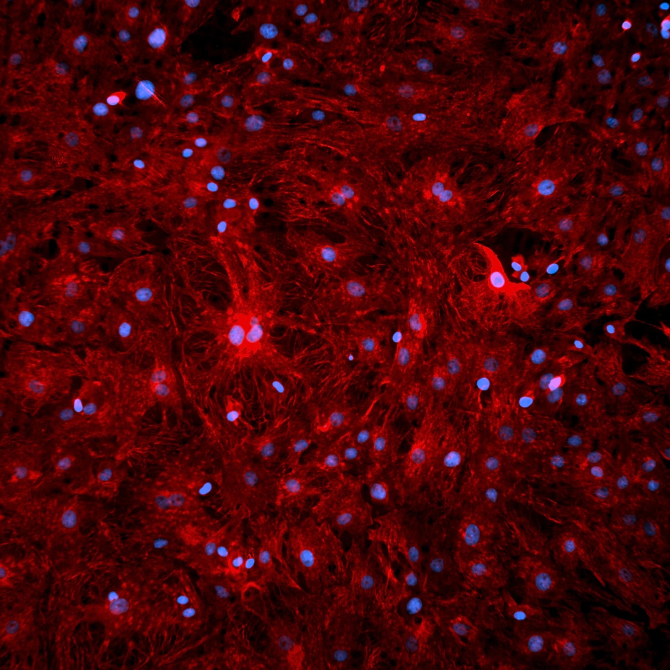Cardio fibroblasts were stained with Vimentin - image 2