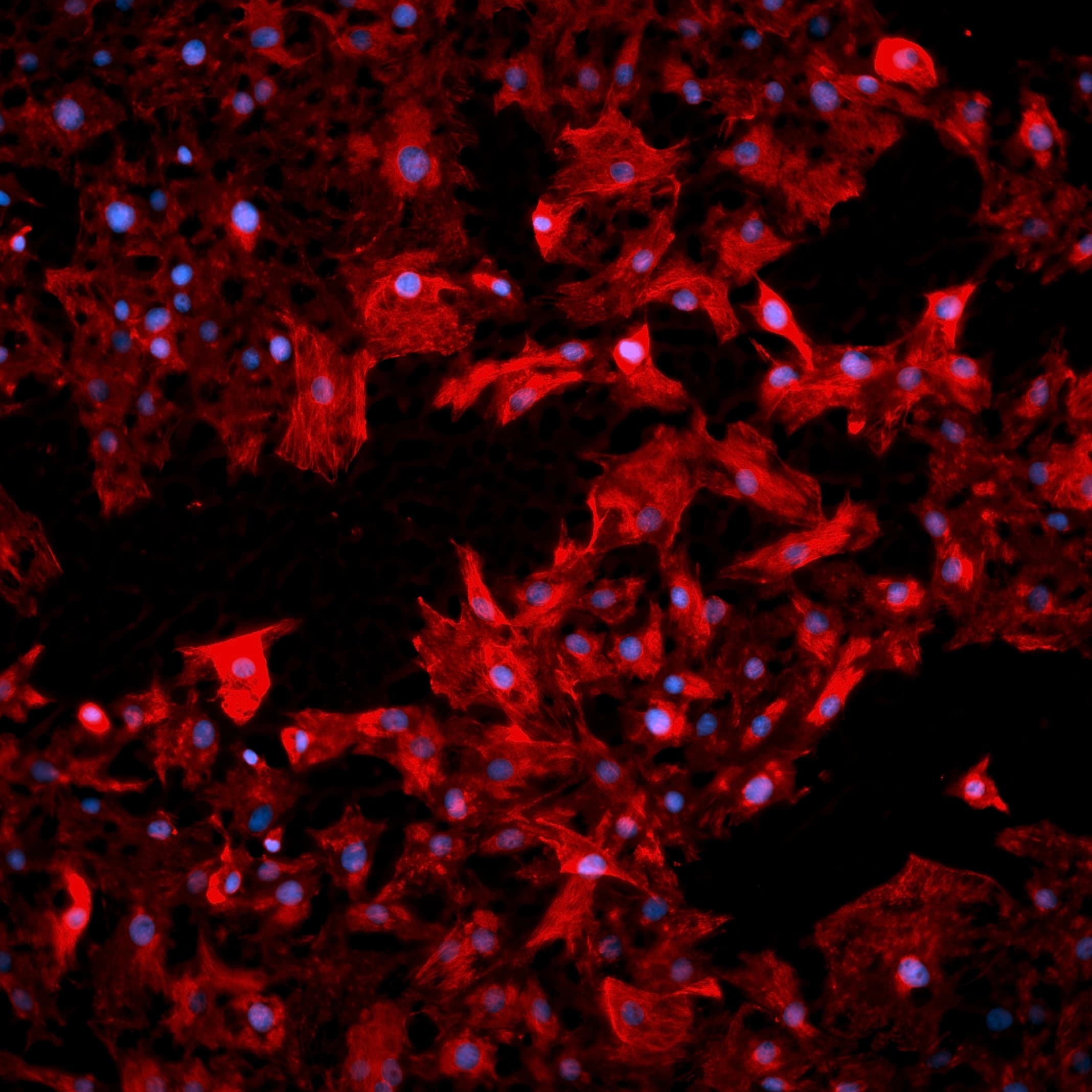 Cardio fibroblasts were stained with Vimentin - image 3