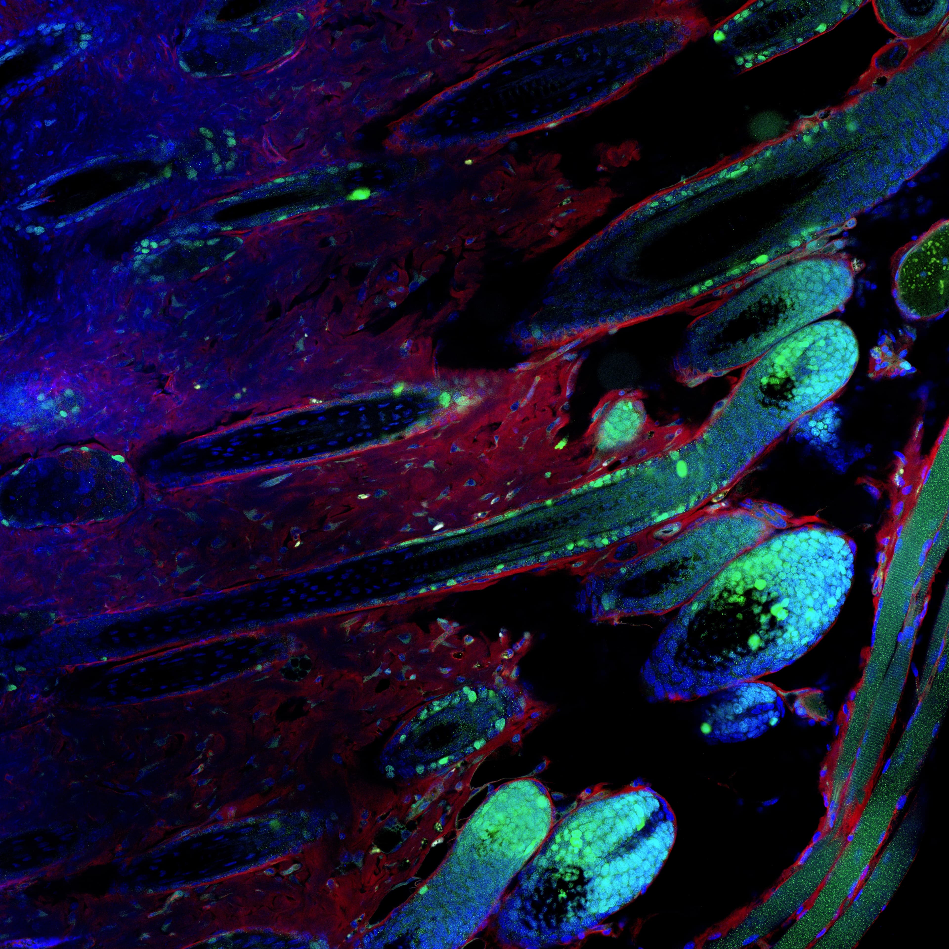 Hair Follicles were stained with Ki67 and K14 - image 2